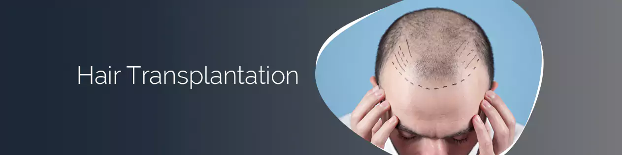 Acne Treatment in Delhi